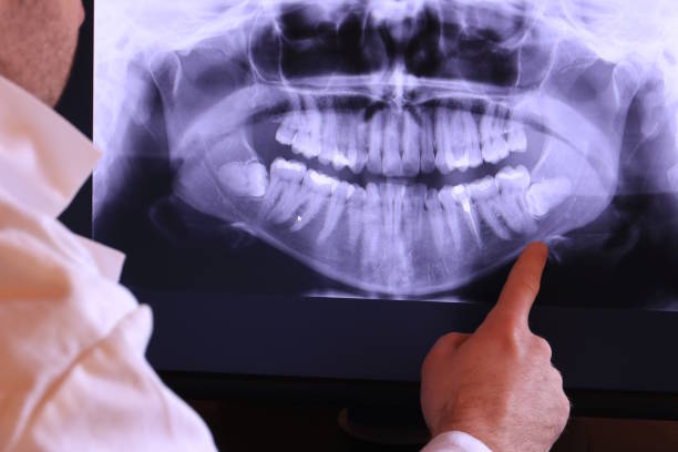 Best Emergency Dental Services for Seniors in Oakwood, IL