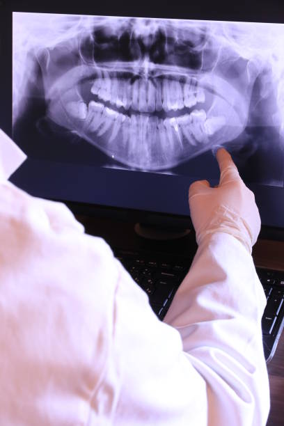Best Emergency Dental Extractions in Oakwood, IL