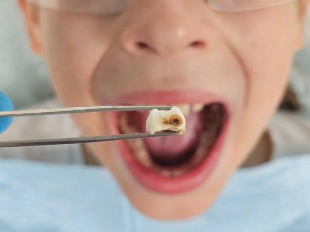 Best Emergency Dentist for Special Needs Patients in Oakwood, IL